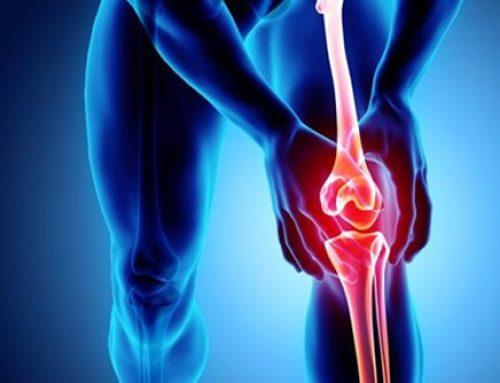 Postoperative considerations for undertaking a joint replacement